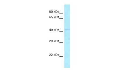 Western Blot: DPEP2 Antibody [NBP2-82910]