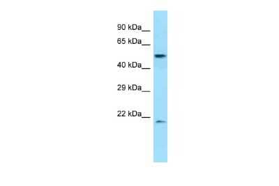 Western Blot: DPEP2 Antibody [NBP2-82911]