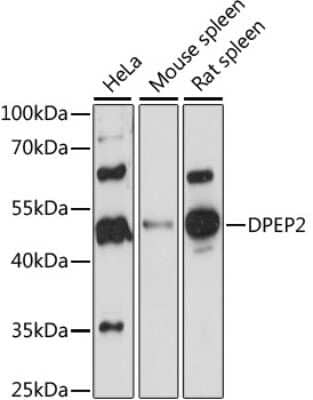 Western Blot: DPEP2 AntibodyAzide and BSA Free [NBP2-92242]