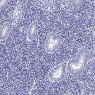 Immunohistochemistry-Paraffin: DPEP3 Antibody [NBP2-32395]
