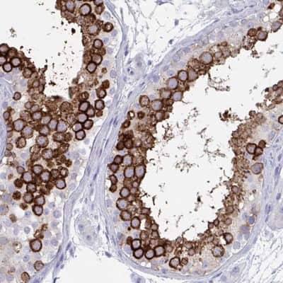 Immunohistochemistry-Paraffin: DPEP3 Antibody [NBP2-32395]