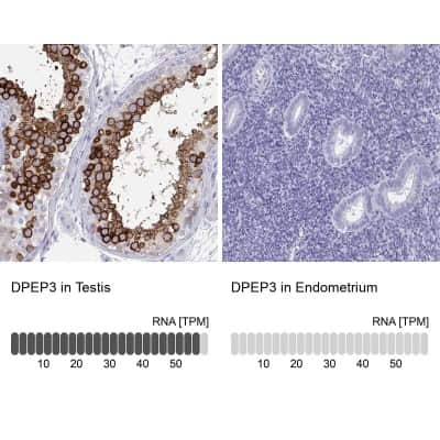 Immunohistochemistry-Paraffin: DPEP3 Antibody [NBP2-32395]