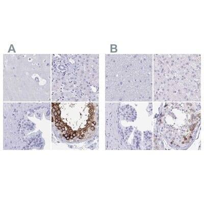 Immunohistochemistry-Paraffin: DPEP3 Antibody [NBP2-32395]