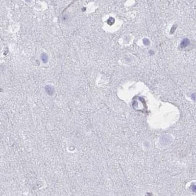 Immunohistochemistry-Paraffin: DPEP3 Antibody [NBP2-32395]