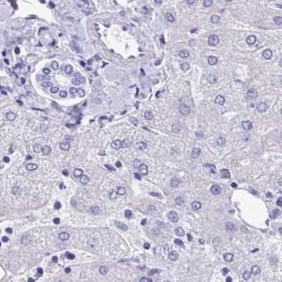 Immunohistochemistry-Paraffin: DPEP3 Antibody [NBP2-32395]