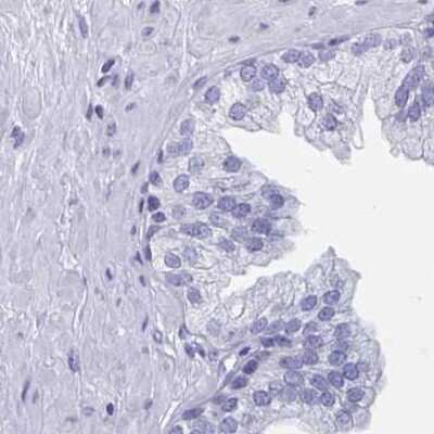 Immunohistochemistry-Paraffin: DPEP3 Antibody [NBP2-32395]