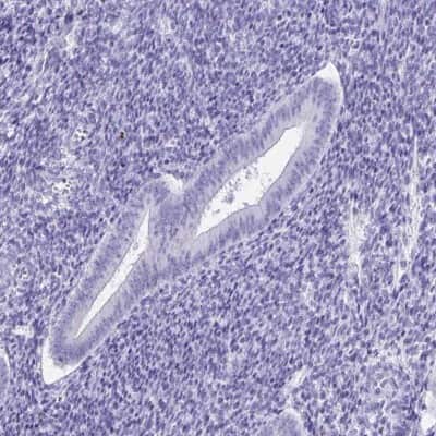 Immunohistochemistry-Paraffin: DPEP3 Antibody [NBP2-34182]