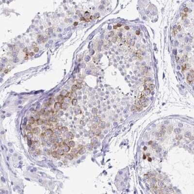 Immunohistochemistry-Paraffin: DPEP3 Antibody [NBP2-34182]