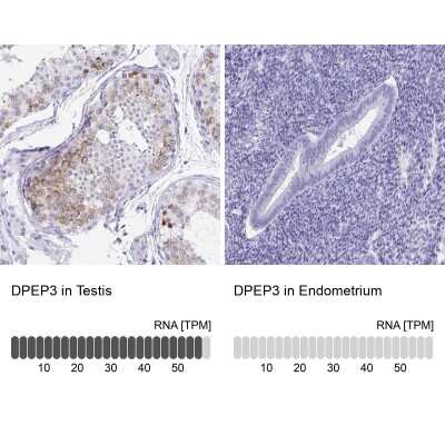 Immunohistochemistry-Paraffin: DPEP3 Antibody [NBP2-34182]