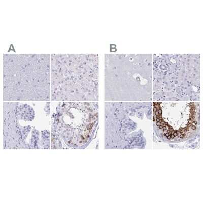 Immunohistochemistry-Paraffin: DPEP3 Antibody [NBP2-34182]
