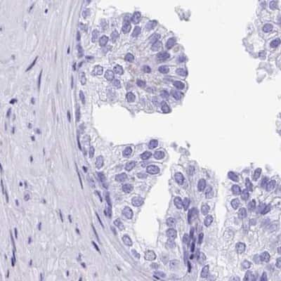 Immunohistochemistry-Paraffin: DPEP3 Antibody [NBP2-34182]