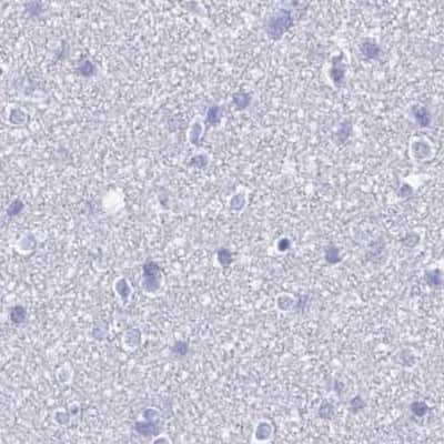 Immunohistochemistry-Paraffin: DPEP3 Antibody [NBP2-34182]
