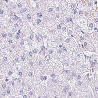 Immunohistochemistry-Paraffin: DPEP3 Antibody [NBP2-34182]