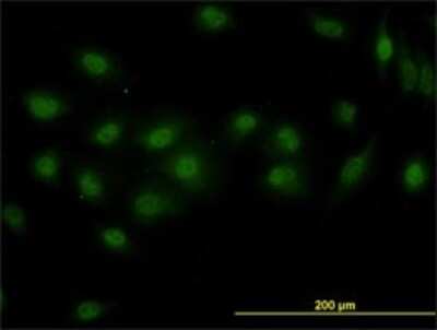 Immunocytochemistry/ Immunofluorescence: DPF2 Antibody (2F6) [H00005977-M01]
