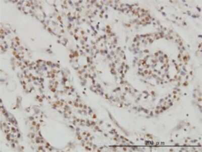 Immunohistochemistry-Paraffin: DPF2 Antibody (2F6) [H00005977-M01]