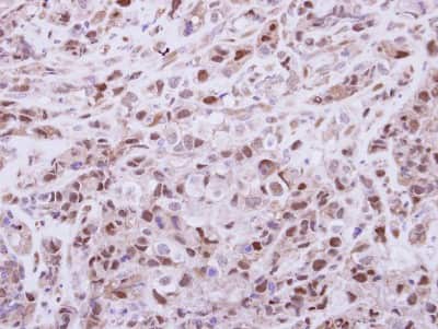Immunohistochemistry-Paraffin: DPF2 Antibody [NBP2-16217]