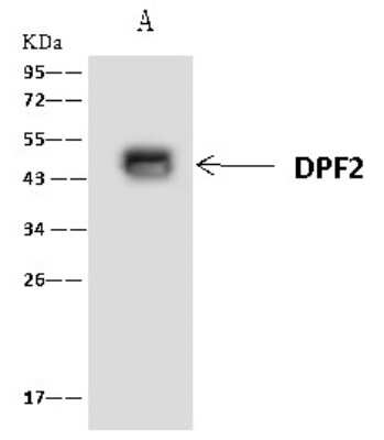 Immunoprecipitation: DPF2 Antibody [NBP2-97764]