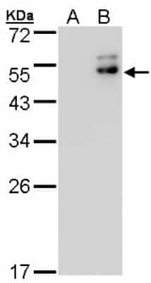 Western Blot: DPF2 Antibody [NBP2-16217]