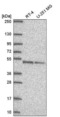 Western Blot: DPF2 Antibody [NBP2-58389]