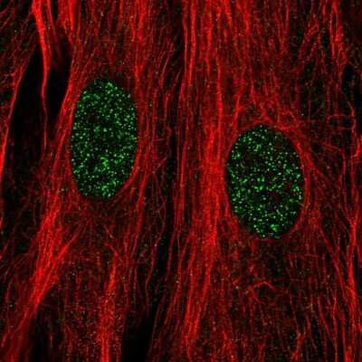 Immunocytochemistry/ Immunofluorescence: DPF3 Antibody [NBP2-57317]