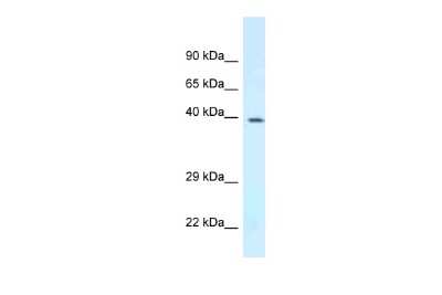 Western Blot: DPF3 Antibody [NBP2-87299]