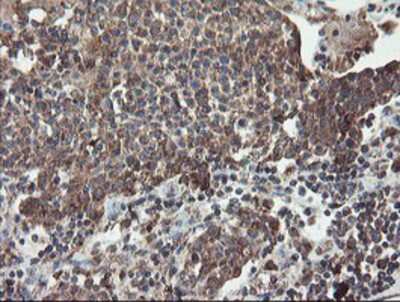 Immunohistochemistry-Paraffin: DPH2 Antibody (OTI4E7) [NBP2-03732]