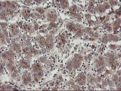 Immunohistochemistry-Paraffin: DPH2 Antibody (OTI4E7) [NBP2-03732]