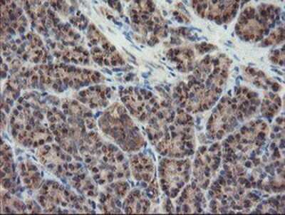 Immunohistochemistry-Paraffin: DPH2 Antibody (OTI4E7) [NBP2-03732]