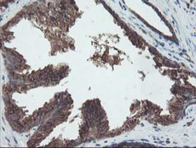 Immunohistochemistry-Paraffin: DPH2 Antibody (OTI4E7) [NBP2-03732]