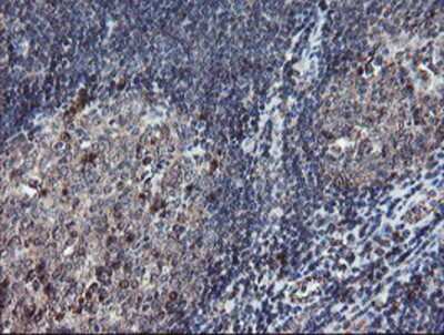 Immunohistochemistry-Paraffin: DPH2 Antibody (OTI4E7) [NBP2-03732]