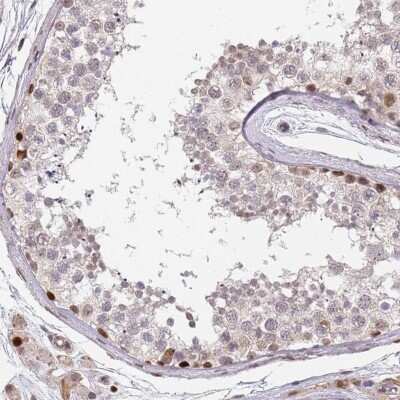 Immunohistochemistry-Paraffin: DPH2 Antibody [NBP2-13933]