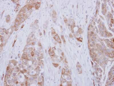 Immunohistochemistry-Paraffin: DPH2 Antibody [NBP2-16218]