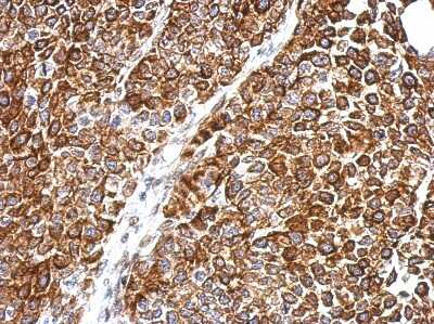 Immunohistochemistry-Paraffin: DPH2 Antibody [NBP2-16219]