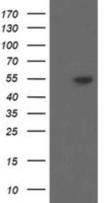 Western Blot: DPH2 Antibody (OTI3A12)Azide and BSA Free [NBP2-70587]