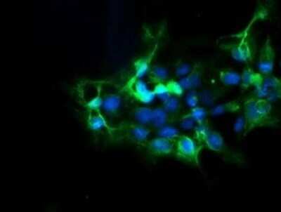 Immunofluorescence: DPH2 Antibody (OTI3A12) [NBP2-46475]