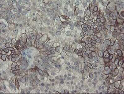 Immunohistochemistry: DPH2 Antibody (OTI3A12) [NBP2-46475]