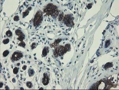 Immunohistochemistry: DPH2 Antibody (OTI3A12) [NBP2-46475]
