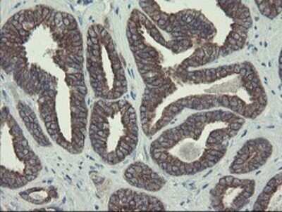 Immunohistochemistry: DPH2 Antibody (OTI3A12) [NBP2-46475]
