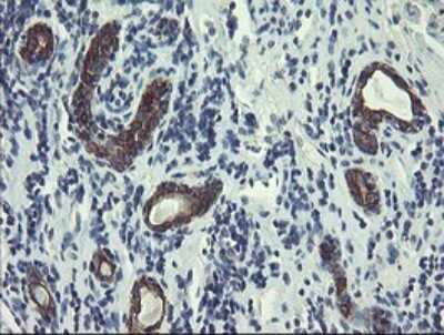 Immunohistochemistry: DPH2 Antibody (OTI3A12) [NBP2-46475]
