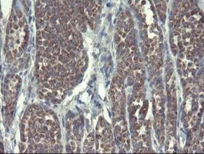 Immunohistochemistry: DPH2 Antibody (OTI3A12) [NBP2-46475]