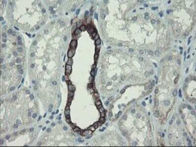 Immunohistochemistry: DPH2 Antibody (OTI3A12) [NBP2-46475]