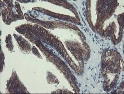 Immunohistochemistry: DPH2 Antibody (OTI3A12) [NBP2-46475]