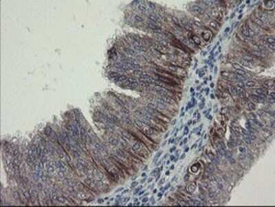 Immunohistochemistry: DPH2 Antibody (OTI3A12) [NBP2-46475]