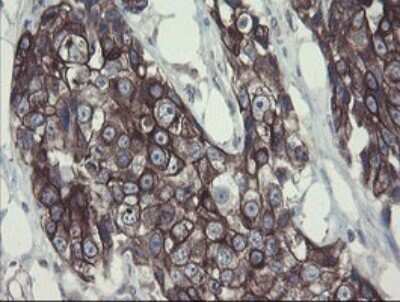 Immunohistochemistry: DPH2 Antibody (OTI3A12) [NBP2-46475]