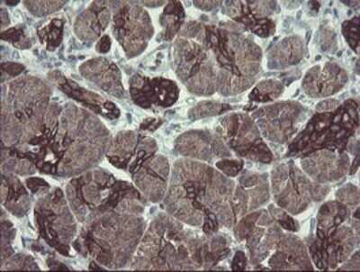 Immunohistochemistry: DPH2 Antibody (OTI3A12) [NBP2-46475]