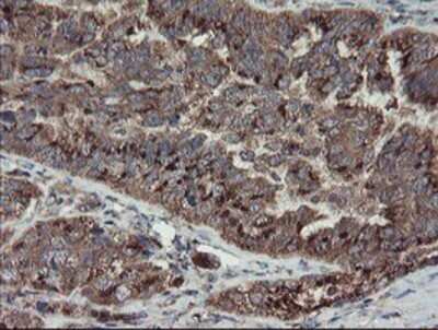 Immunohistochemistry: DPH2 Antibody (OTI4E7) - Azide and BSA Free [NBP2-70585]