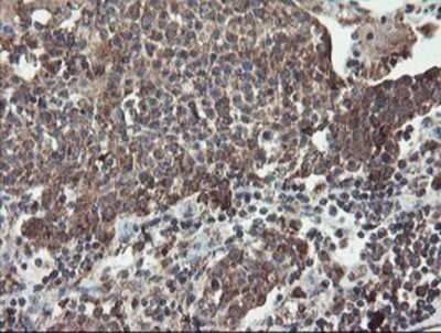 Immunohistochemistry: DPH2 Antibody (OTI4E7) - Azide and BSA Free [NBP2-70585]