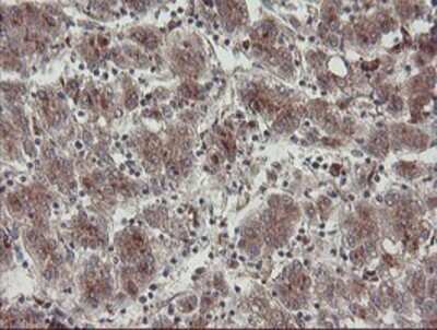 Immunohistochemistry: DPH2 Antibody (OTI4E7) - Azide and BSA Free [NBP2-70585]