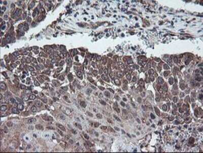 Immunohistochemistry: DPH2 Antibody (OTI4E7) - Azide and BSA Free [NBP2-70585]