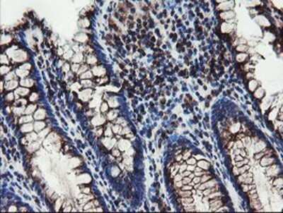 Immunohistochemistry: DPH2 Antibody (OTI4E7) - Azide and BSA Free [NBP2-70585]